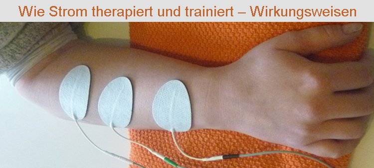 Krauth+Timmermann Elektrostimulation. Workshop- Wie Strom therapiert und trainiert