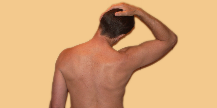 Muskeltrigger Therapie in der Heilpraktik – Fachartikel von Walter Kasper
